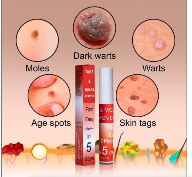 Tags & Moles Remover