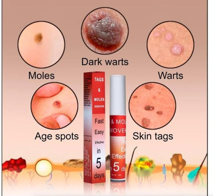 Tags & Moles Remover